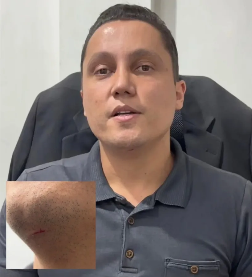 Brinell garante ter sido agredido pelo presidente da Câmara de Timóteo